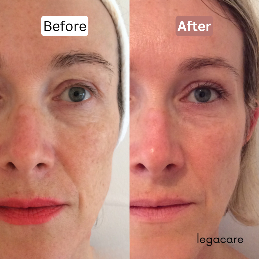 Anti-Aging Multi Balm